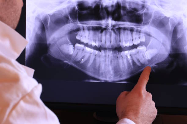 Best Walk-In Emergency Dentist in Pecan Plantation, TX
