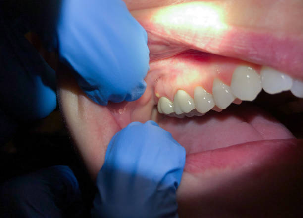 Best Same-Day Emergency Dentist in Pecan Plantation, TX